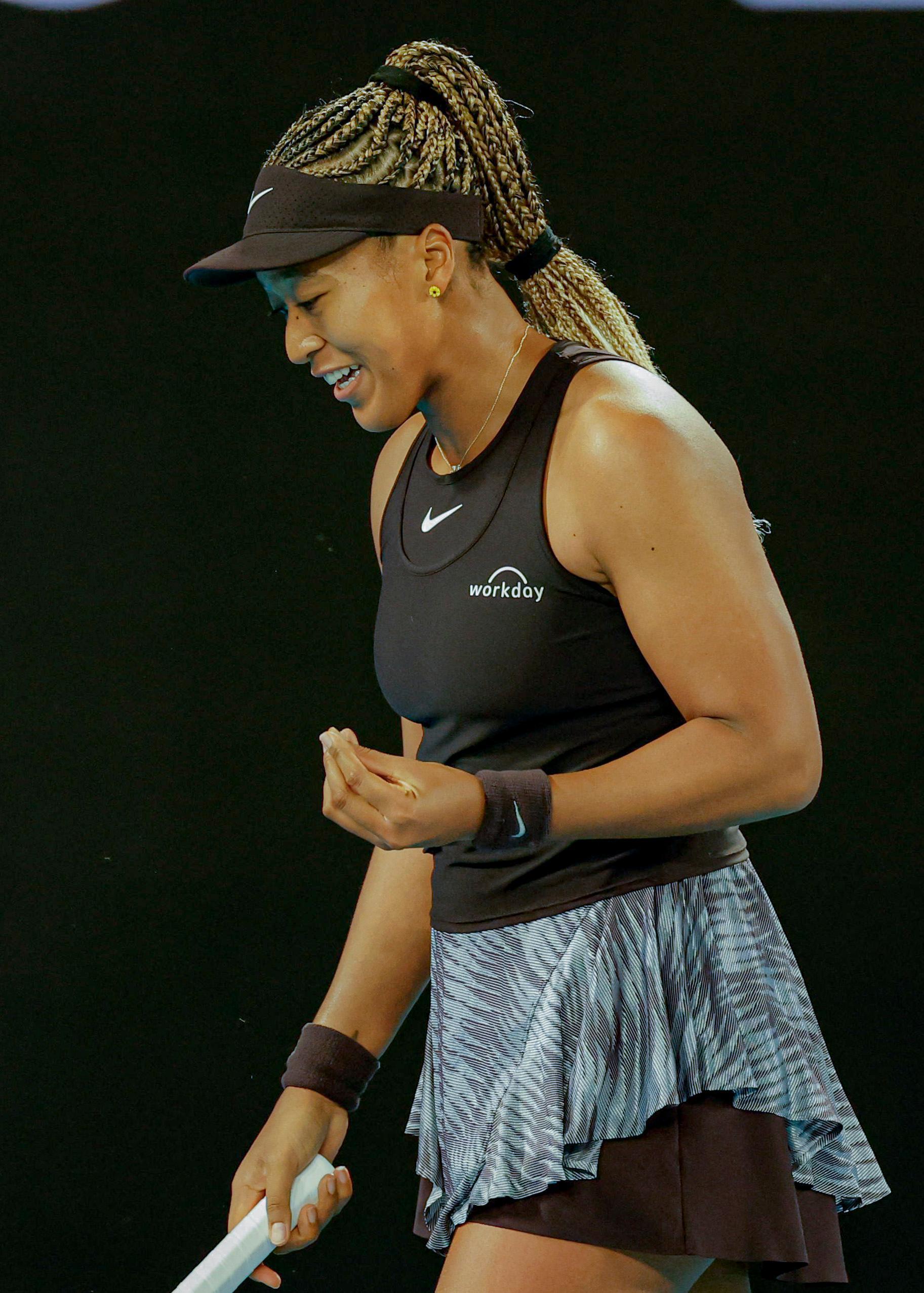 包含大坂直美在德国队比赛中回归赛场，精彩发挥引发热议！的词条